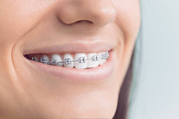 Best Full Mouth Reconstruction  in St Paul, MN
